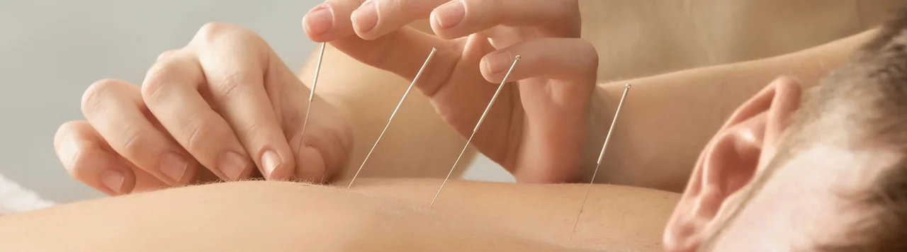 Alternative Therapies for Endometriosis: Acupuncture, Massage, and More