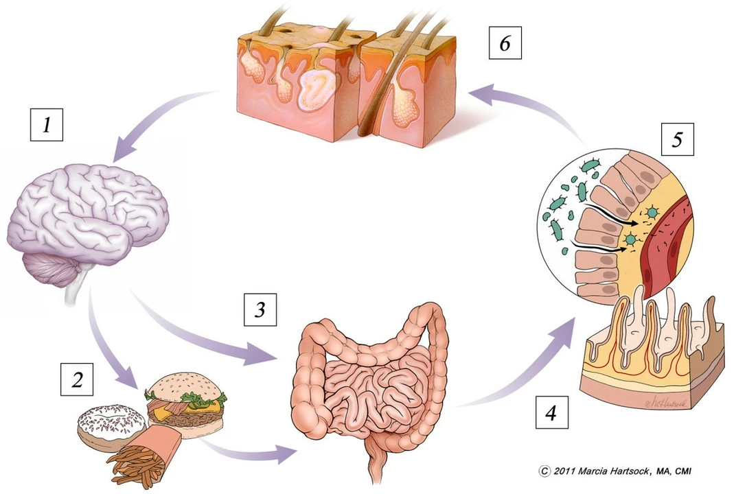 Probiotics and Gut-Brain Axis: The Connection Explained